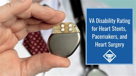 You cannot double dip the same organ, in other words they can pay you for. . Pacemaker effect on va disability rating